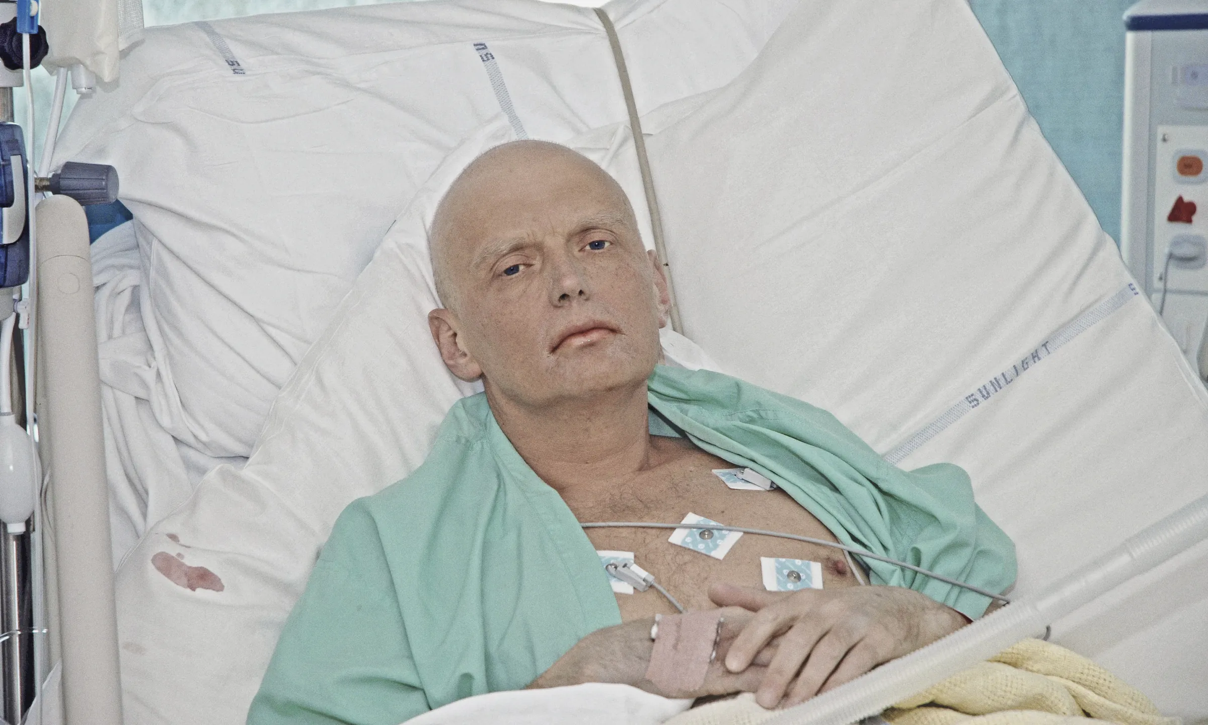 Alexander Litvinenko in a hospital bed at University College Hospital on 20 November 2006, three days before he died, his hair gone and heart-monitor leads on his chest, looking at the camera.